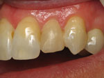 After Image