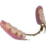 Invisalign Tray